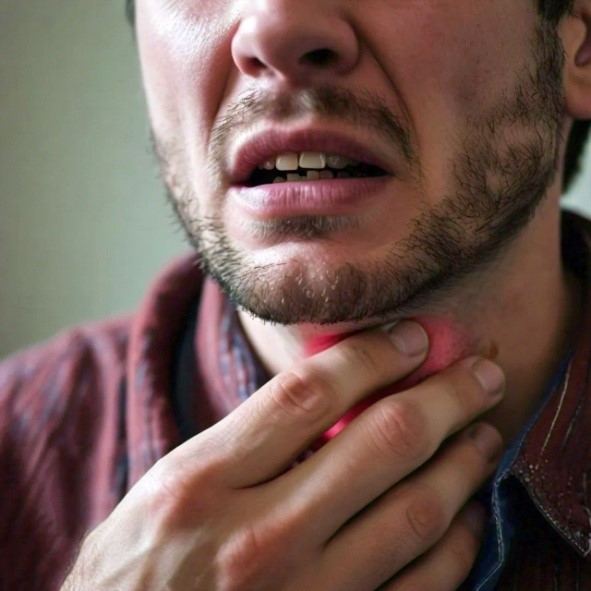 Eosinophilic Esophagitis